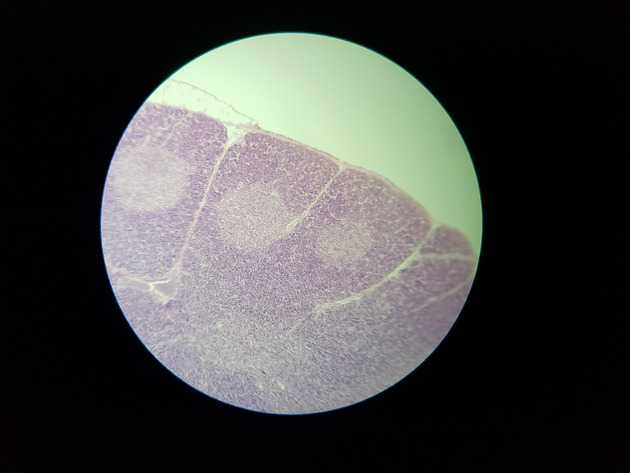 Thymus Slides - Thymus 005 100X
